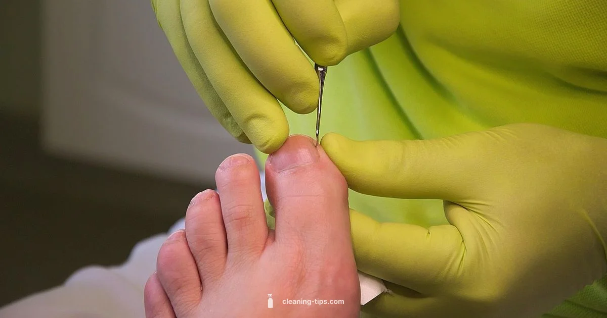Ingrown Nail Care Ingrown Nail Care - Cleaning Tips